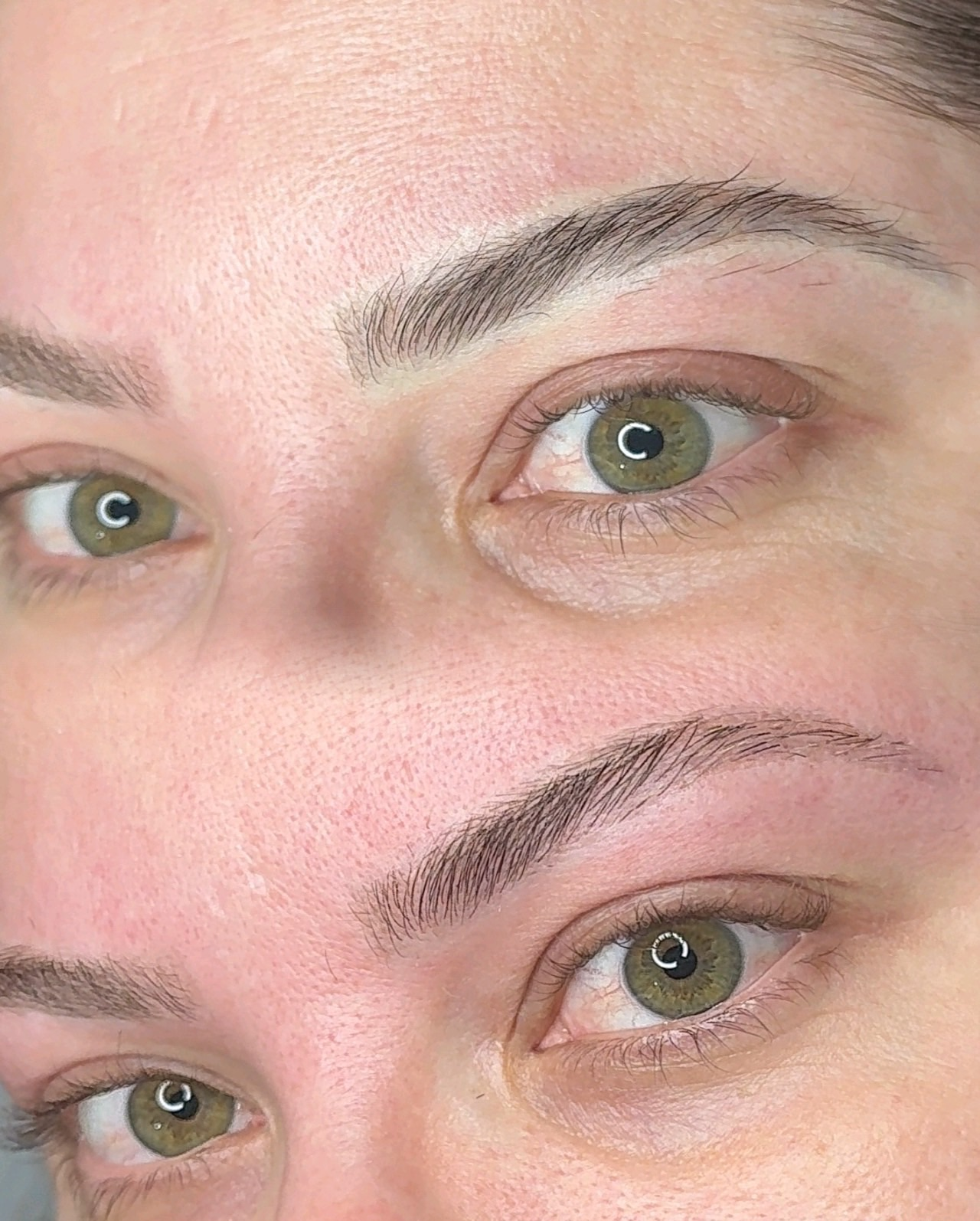 Registro real de remoção a laser: Micropigmentação